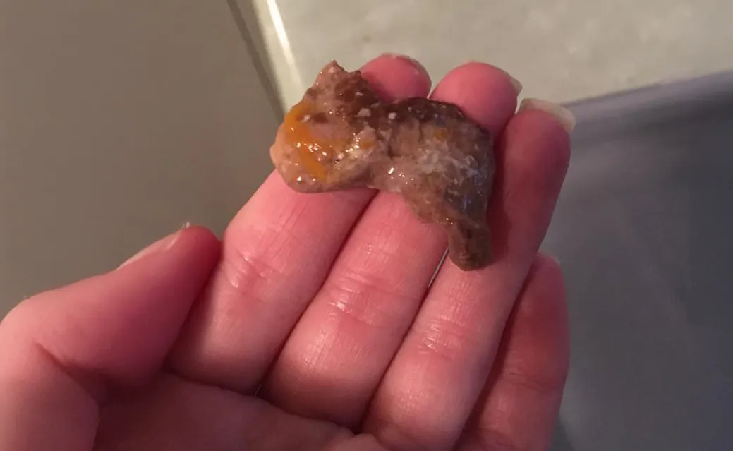 And Unlike the Heimlich, it Works