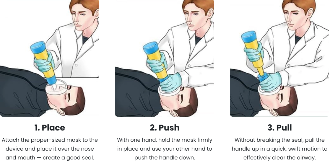 The AirSeal Suction Method™ — When Strength and Technique Don’t Matter